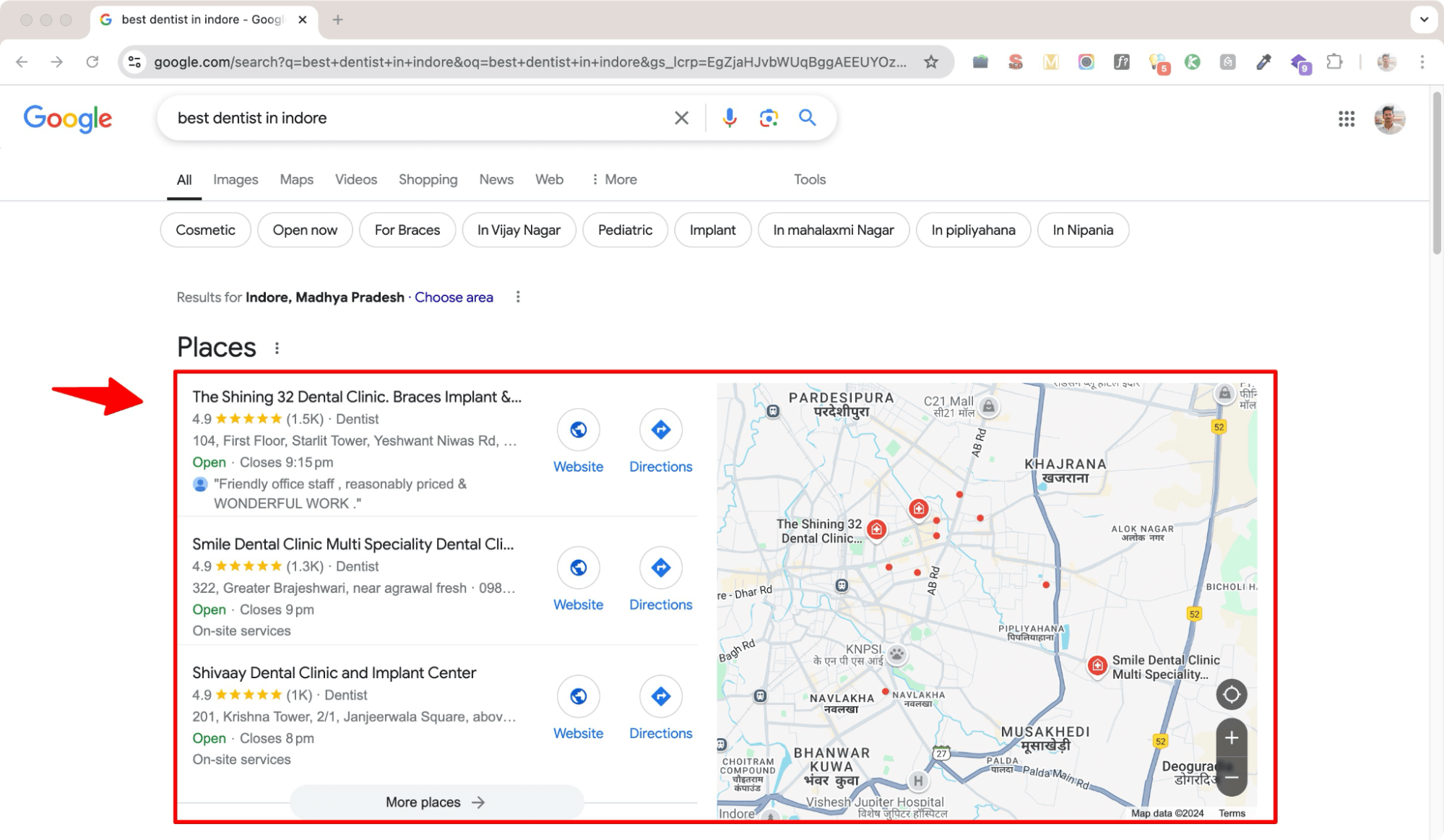 Local SEO results for best dentist in Indore search.